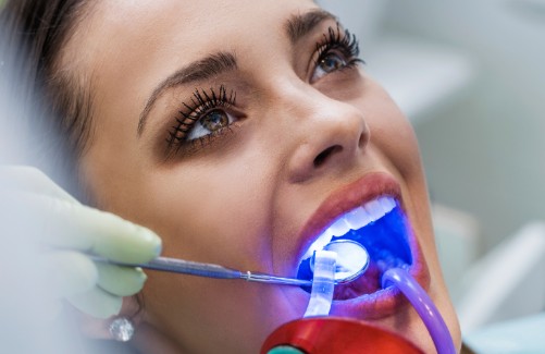 Dental Laser Procedures, Courtenay Dentist